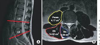 There are other words that are related to legal documents and where when preparing to sign, picture an imaginary area that is 1 inch in length downward and the full width of the check across the full width of the check. Association Between Cross Sectional Areas Of Lumbar Muscles On Magnetic Resonance Imaging And Chronicity Of Low Back Pain Semantic Scholar