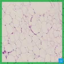 Adipose tissue is a type of connective tissue that is composed mainly of adipocytes. Adipose Tissue Definition Location Function Kenhub