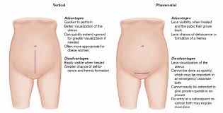 Pin By Cells4life Espana On Semana De La Cesarea Child Nursing Nursing Care Plan Nursing Notes