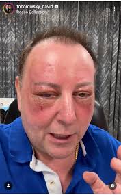 I think I'm getting old and ugly 💔💔💔 is that true please be honest 🥺🥺  if that's a lie can I get a huge YESS