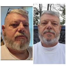 Dealing with loss of appetite