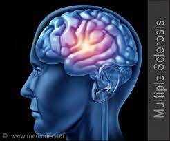 Multiple sclerosis is a disease of the central nervous system that results in the malfunctioning of the brain's communication with the nerves. Quiz On Multiple Sclerosis