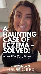 If you're dealing with eczema, you know itch can be one of the most  miserable parts. It's constant. It disrupts your sleep. It makes you  irritable, anxious, and exhausted. Here's the kicker -