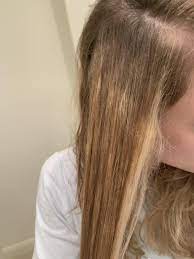 Help Botched Color Bleach Job At Home Very Uneven And Spotty What Do I Do Only Done Highlights Bleached Hair Bleached Hair At Home Celebrity Hair Colors