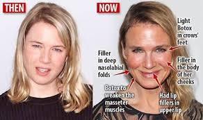 Geraldine 1 weeks ago #8 she. Renee Zellweger Plastic Surgery Disappointment Quotes
