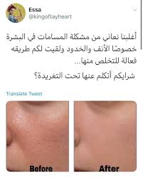 شواخي Shoa5y1988 Twitter