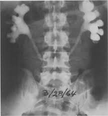 Image result for Methysergide