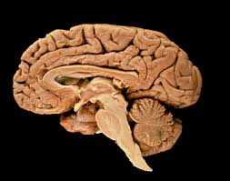 Image result for Brain Lesion