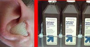 How To Use Hydrogen Peroxide For Ear Infections Peroxide For Ear Infection Ear Infection Remedy Ear Infection