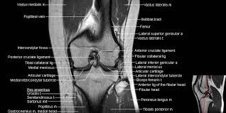 The muscles of the knee include the quadriceps, hamstrings, and the muscles of the calf. Mri Knee Anatomy Mri Knee Mri Meniscus Tear