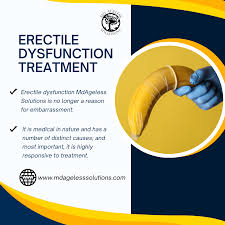 Image result for Erectile Dysfunction Management