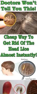 Doctors Won T Tell You This Cheap Way To Get Rid Of The Head Lice Almost Instantly Head Louse Head Lice Remedy Louse