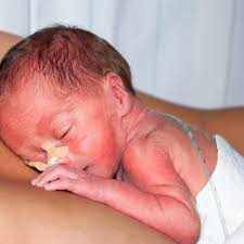 Zonder gerichte investeringen en multidisciplinaire samenwerking blijven de  jongste en meest kwetsbare patiënten verstoken van de medische innovatieve  hulp die zij hard nodig hebben. Innovatie in de neonatologie is geen luxe,  maar