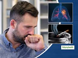 Shortness of breath, chest pain, or a cough (even coughing up blood) may. Nonsmokers With Lung Cancer Cases Increased By 35 Dr Pankaj Kumar Pandey