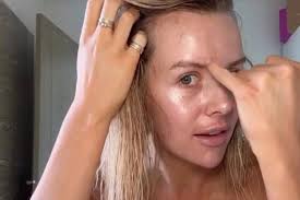 Love Island's Faye Winter emotional as she goes makeup and filter free in  video after skin procedure