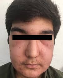 Journal of General and Family Medicine: Vol 25, No 4