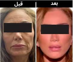 قبل عملية التجميل.. طبيب ريهام سعيد يرد عليها بصور مفاجئة – الأسبوع