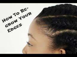 Top hair styles for afro americans no edges. Three Tips To Revive Those Thinning Edges Natural Hair Styles Grow Thick Long Hair Long Hair Styles