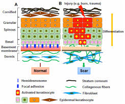 Between the epidermis and dermis lies the basement membrane, which keeps the outer layer adhered closely to the lower layer. Abnormalities In The Basement Membrane Structure Promote Basal Keratinocytes In The Epidermis Of Hypertrophic Scars To Adopt A Proliferative Phenotype