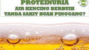 Eh, kenapa air kencing berbuih ni? Kencing Berbuih Kunyit Hitam Black G