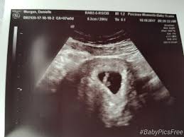 Is 7 weeks too early for an ultrasound? Early Scan 7 Weeks Today