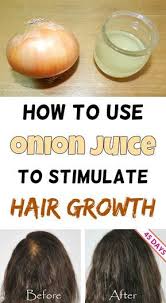 Onion For Hair Growth Onion For Hair Growth Reviews Onion Juice Hair Growth Success Onion Hair Regrowth Succ Onion Juice For Hair Onion For Hair Hair Growth
