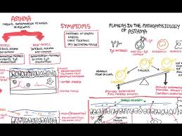 Asthma Pathophysiology Youtube