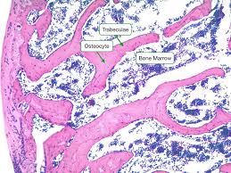 I also don't like how the bone and the marrow is. Bone Reading Php Lab