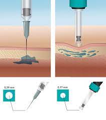 Handelt es sich einerseits um gentechnisch veränderte pflanzenarten, die wie tabak. Nadelfreie Injektion Wikipedia