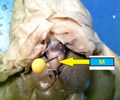 Lvlupfit.comwhat organ in just underbthe bottom left rib / part of your pancreas lies just below your left ribs in the middle of your upper abdomen. Ywlzcur4zvawum
