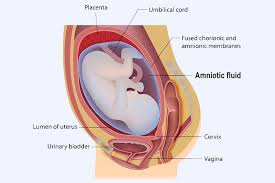 leaking amniotic fluid signs causes and treatment