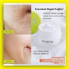 Pelembab merupakan salah satu produk komersial yang banyak tersedia di pasaran. Wajib Konsul Moisturizing Cream Evana Super Lembut Dan Halus Diwajah Mengatasi Kulit Kering Shopee Indonesia