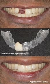 Pin On Dental Health