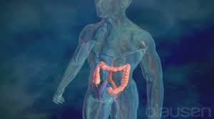 $ick watch the latest video from norwegian kvalme (@norwegiankvalme). Tykktarmskreft Symptomer Og Tegn Nhi No