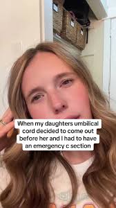 How rude of her to give me birth trauma. #rude #fyp #trend #csection #mom