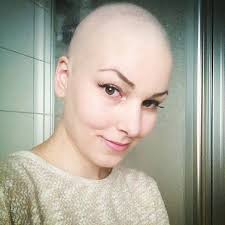 das wuselige da oben sind keine pixel sondern haare naja nennen wir es flaum d aber es wachst selfie nohairdontcare bald baldie confessionsofabaldie