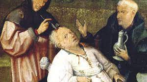 Diese jahreszahlen geben das ende des weströmischen reiches, kaiser justinians tod und. Medizin Des Mittelalters Gesund Dank Aderlass Und Loch In Der Schadeldecke Welt