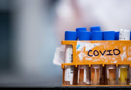 As the pandemic continues, the health and safety of our community remains the university of manitoba's top priority, while still aiming to fulfill our mission of academic. 100 New Covid 19 Cases In Manitoba On Saturday One Death Chrisd Ca