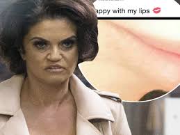 Danniella Westbrook debuts new plumped up lips but fans are NOT impressed,  saying 'I'd be suing someone if I were you'