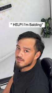 Barber Gave Me A Bald Spot