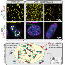 These contrast with benign tumors, which do not spread. Cancer Mutations Of The Tumor Suppressor Spop Disrupt The Formation Of Active Phase Separated Compartments Sciencedirect