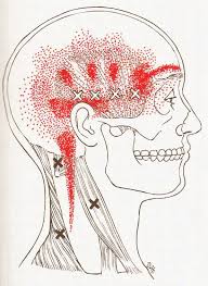 Pin On Trigger Point