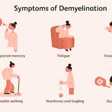 Vitamin d, cannabis, and cannabinoids. Demyelination Symptoms Causes Diagnosis Treatment