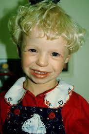 Williams Syndrome Net Health Book