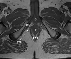 Maybe you would like to learn more about one of these? Mri Of The Male Pelvic Floor Radiographics