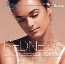 Ovale,9 and many patients report. Redness You May Be Suffering From A Skin Condition Called Rosacea Rosacea May Cause Uncomfortable Flushi Rosacea Skin Care Rosacea Causes Rosacea Treatment