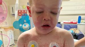 Fundraiser by Dominique Martin : Completing Half Marathon to Fight against  Kawasaki Disease