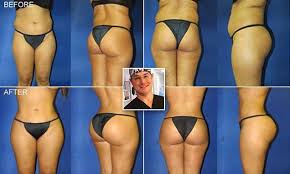 Pin On Plastic Surgery