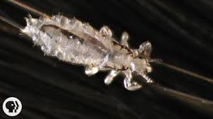 Lice treatment, lice screenings, lice treatment and prevention products. How To Treat Head Lice Kelture Aveda Best Hair Salon In Singapore