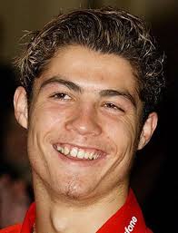 ronaldo before plastic surgery